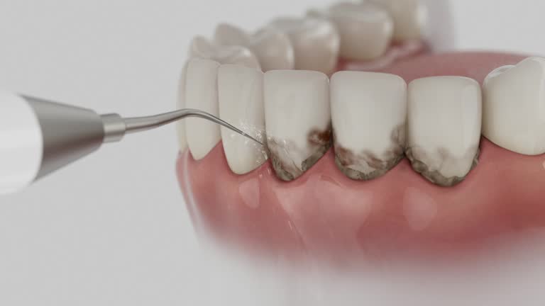 Trusted Dental Implants service in Farmington, MI - Dentist Open Now